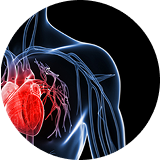 Myocarditis