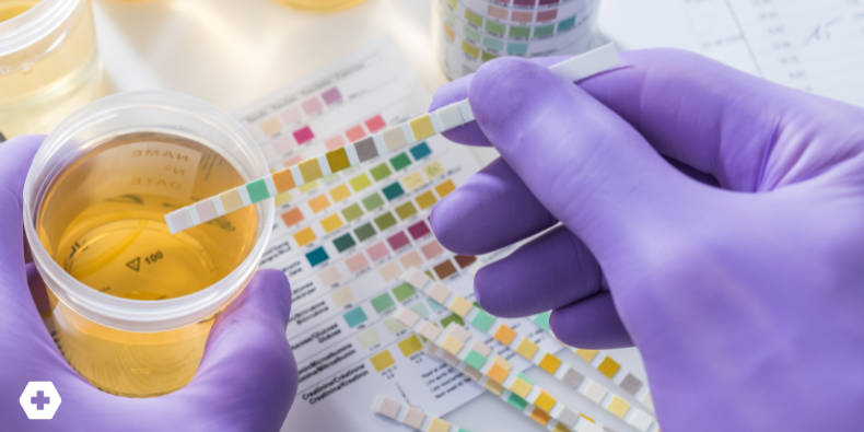 Urine the Know: Using Drug Screens Wisely in Primary Care